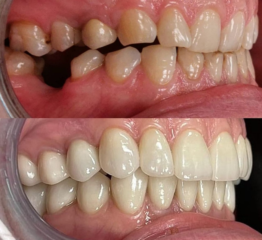 Стоматолог-эксперт о врачебных ошибках: как пациенту отстоять свои права